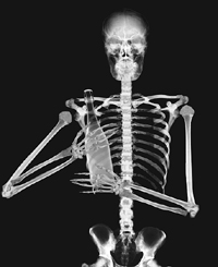 bones.jpg